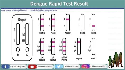 igg meaning tagalog|View of Should IgM/IgG rapid test kit be used in the diagnosis of .